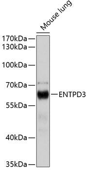 ENTPD3 Rabbit pAb