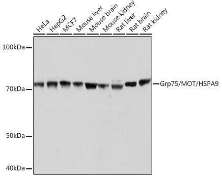 Grp75/MOT/HSPA9 Rabbit mAb