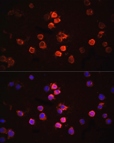 IL1β Rabbit pAb