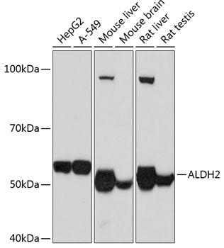 ALDH2 Rabbit mAb
