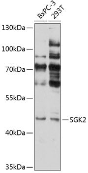 SGK2 Rabbit pAb