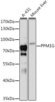 PPM1G Rabbit pAb