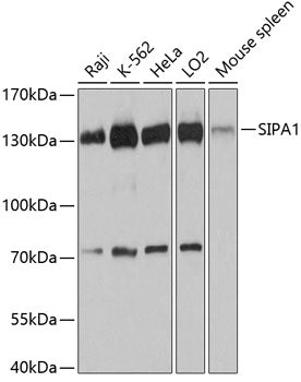 SIPA1 Rabbit pAb