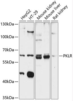 PKLR Rabbit pAb