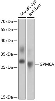 GPM6A Rabbit pAb