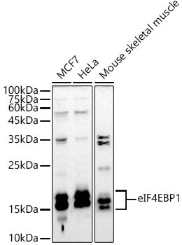 eIF4EBP1 Rabbit pAb