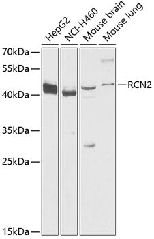 RCN2 Rabbit pAb
