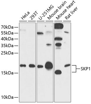 SKP1 Rabbit pAb