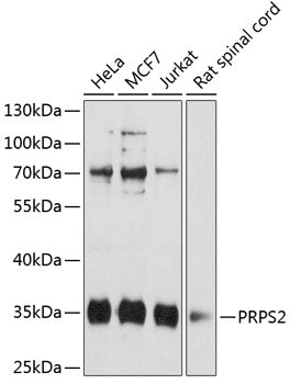 PRPS2 Rabbit pAb