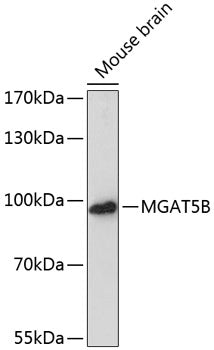 MGAT5B Rabbit pAb