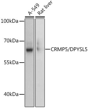 CRMP5/DPYSL5 Rabbit pAb