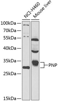 PNP Rabbit pAb