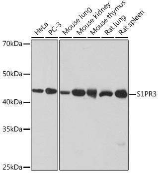 S1PR3 Rabbit mAb
