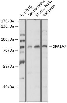 SPATA7 Rabbit pAb