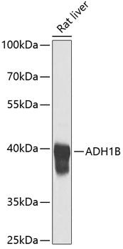 ADH1B Rabbit pAb