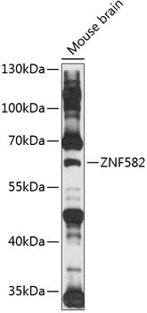 ZNF582 Rabbit pAb