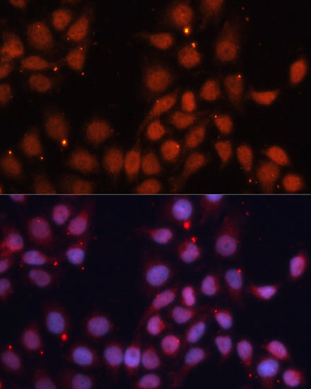 CDK11B Rabbit pAb