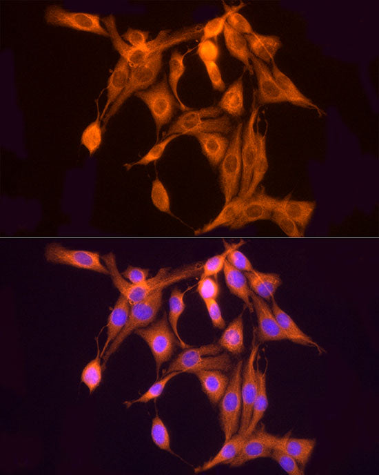 ULBP2 Rabbit pAb