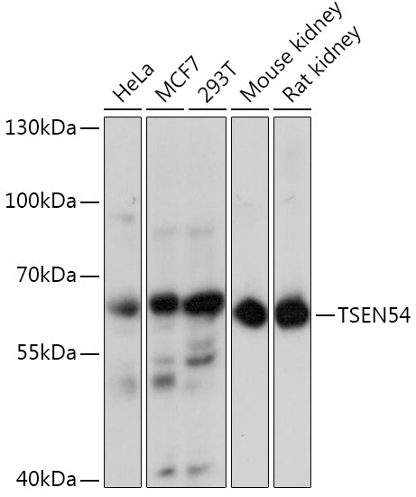 TSEN54 Rabbit pAb