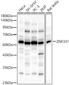 ZNF331 Rabbit pAb