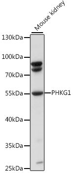 PHKG1 Rabbit pAb