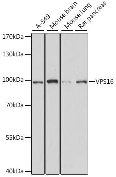 VPS16 Rabbit pAb