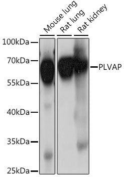 PLVAP Rabbit pAb