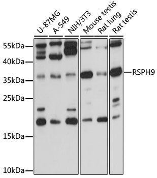 RSPH9 Rabbit pAb