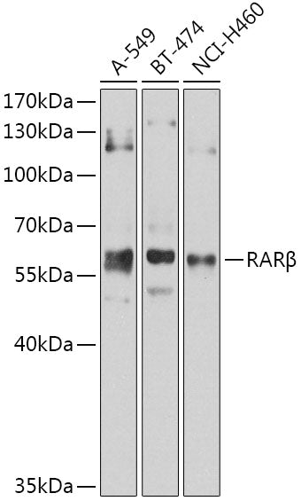 RARβ Rabbit pAb