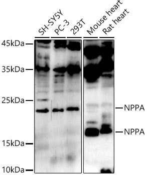 NPPA Rabbit pAb
