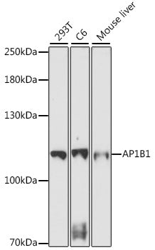 AP1B1 Rabbit pAb
