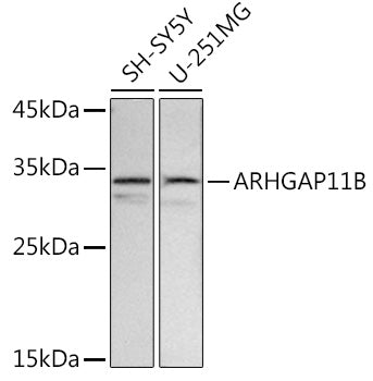 ARHGAP11B Rabbit pAb