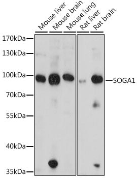 SOGA1 Rabbit pAb