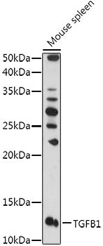 TGF beta 1 Rabbit pAb