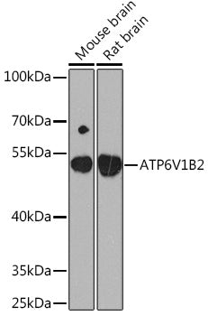ATP6V1B2 Rabbit pAb