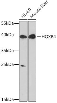 HOXB4 Rabbit pAb