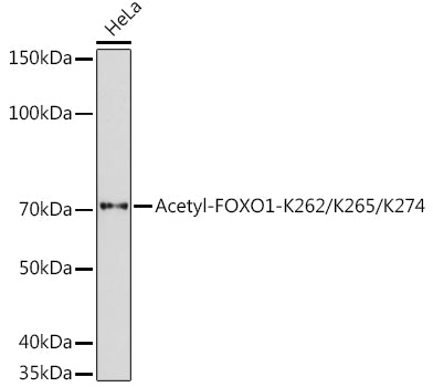 Acetyl-FOXO1-K262/K265/K274 Rabbit pAb