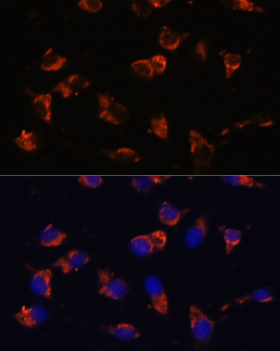 CA19-9 Mouse mAb