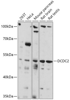 DCDC2 Rabbit pAb