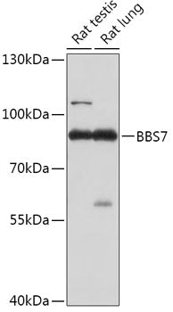 BBS7 Rabbit pAb