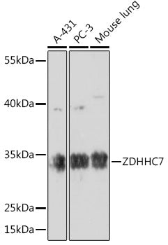 ZDHHC7 Rabbit pAb