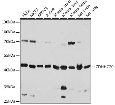 ZDHHC20 Rabbit pAb