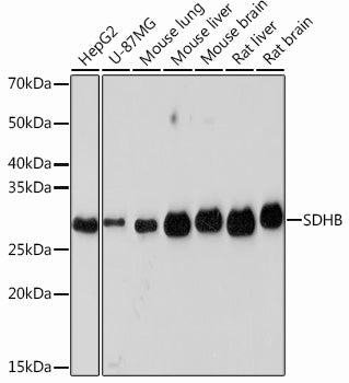 SDHB Rabbit mAb