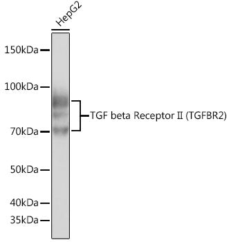 TGF beta Receptor II (TGFBR2) Rabbit mAb