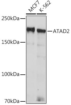 ATAD2 Rabbit mAb