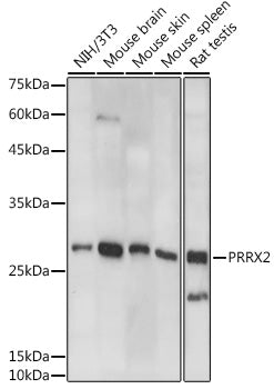 PRRX2 Rabbit pAb