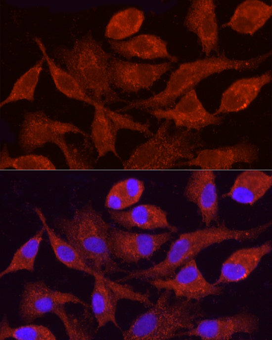 CYP4F11 Rabbit pAb