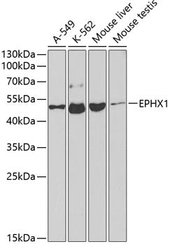 EPHX1 Rabbit pAb