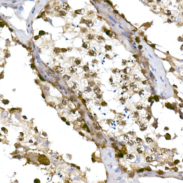 TET1 Rabbit mAb