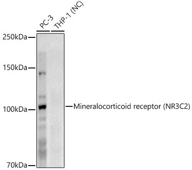 Mineralocorticoid receptor (NR3C2) Rabbit mAb